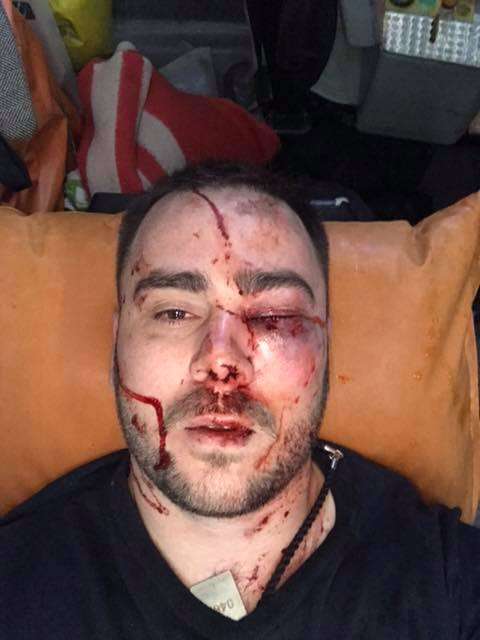 У Запоріжжі побили відомого активіста