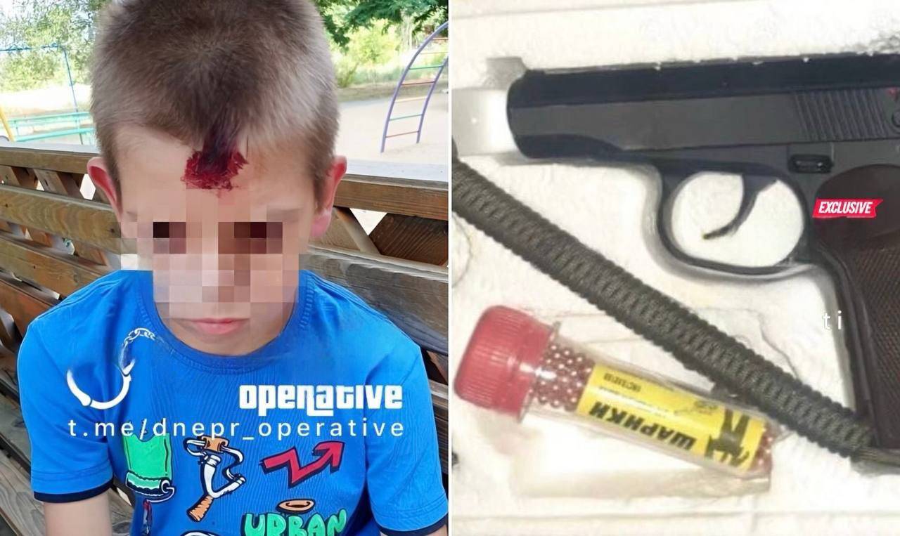 Військовий обстріляв дитячий майданчик у Кривому Розі: 10-річний хлопчик отримав поранення в голову