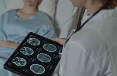 Мозкові імпланти від Neuralink почали тестувати у Британії