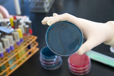 Фото uk.wikipedia.org/wiki/Сальмонельоз